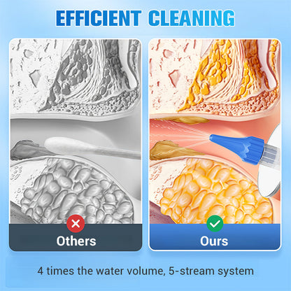 Safe & Gentle Ear Wax Removal Kit 4X Water Volume, 5 Streams For Effective Cleaning